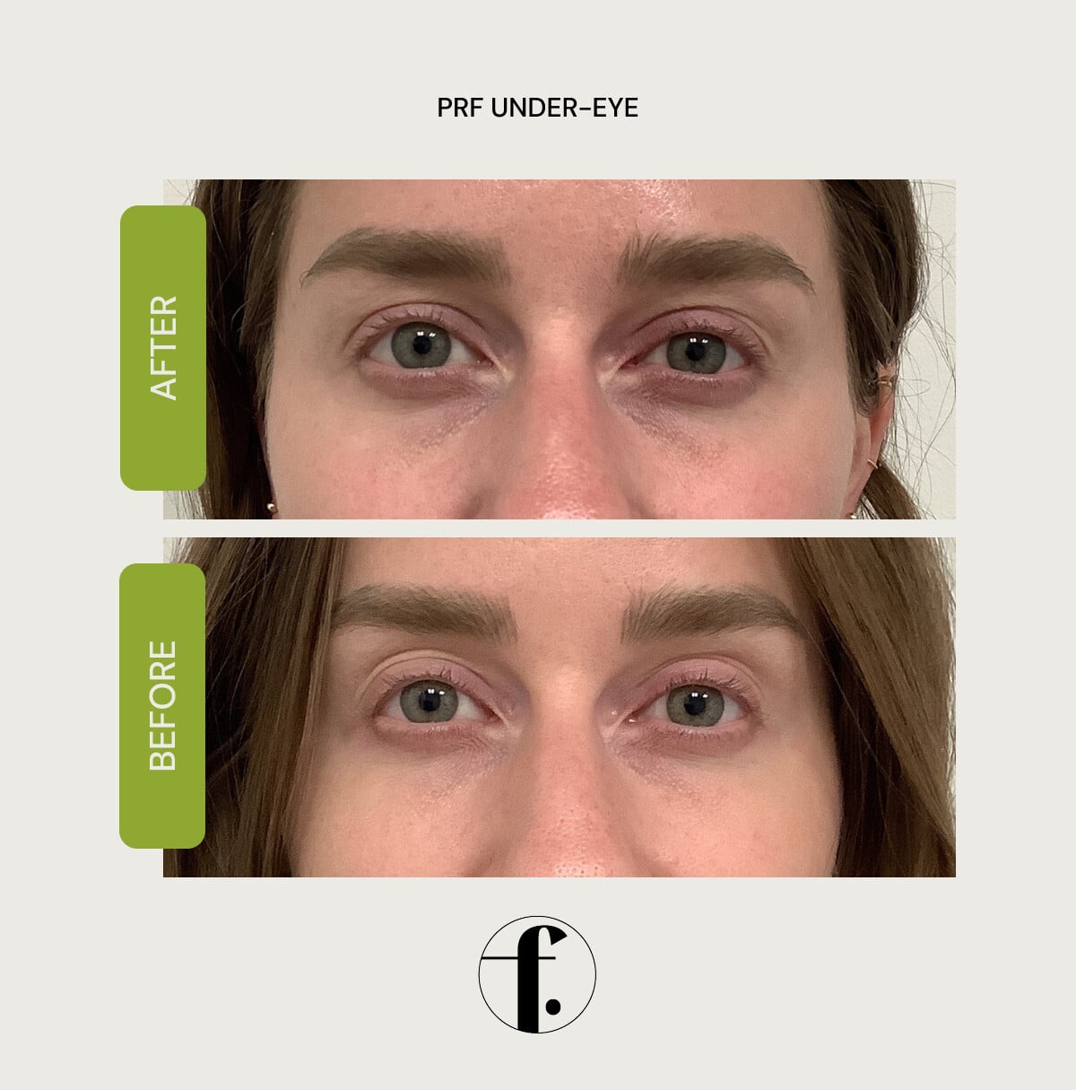 18-home-comparison.jpg