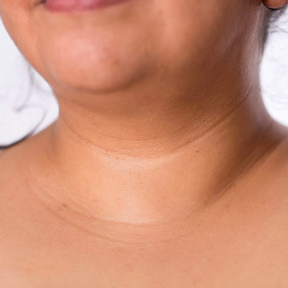 necklace lines