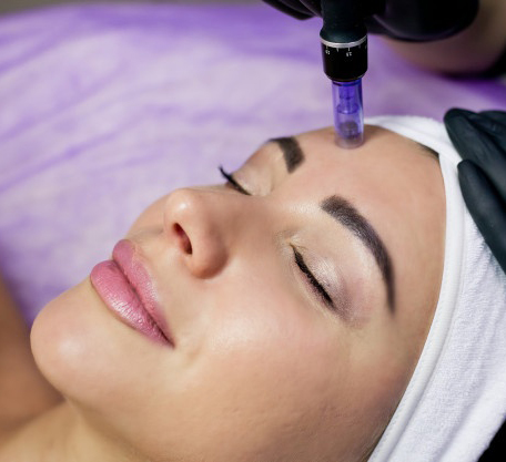 beautician makes injections intoz forehead mesotherapy with microneedle method 209198 95