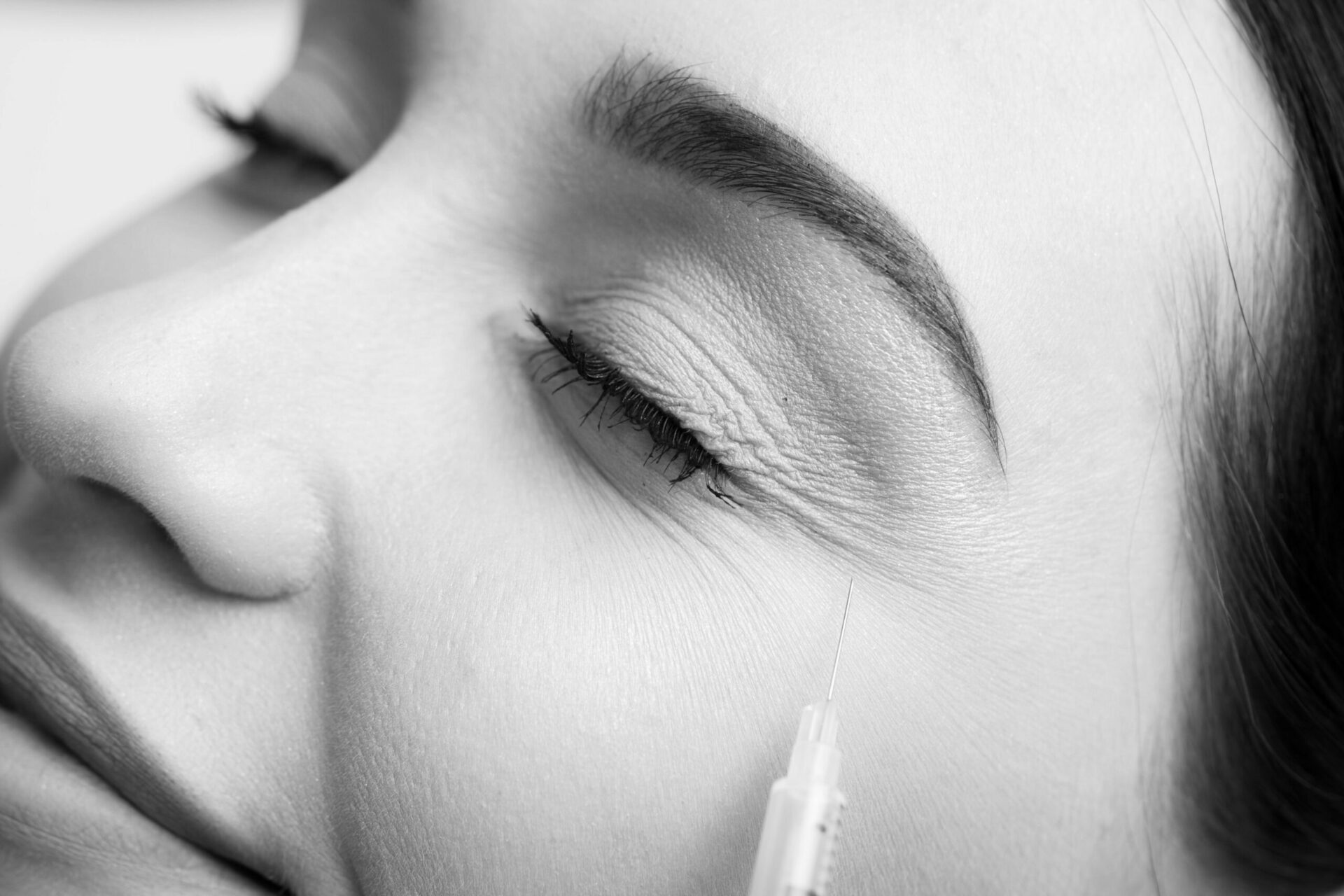 how to prepare for botox treatment scaled
