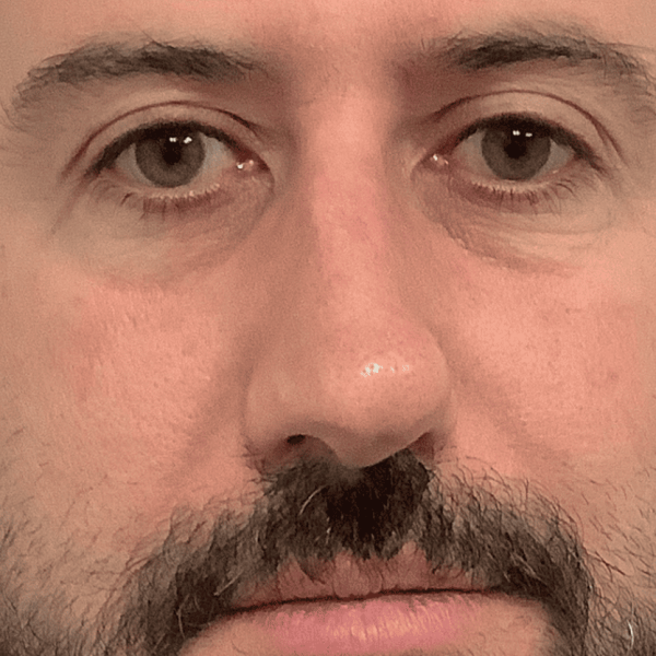 ba_prf_after_01b.png