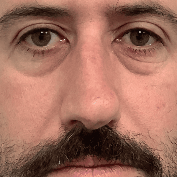 ba_prf_before_01a.png