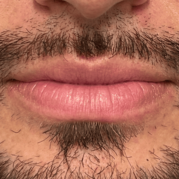 lip_03a.png