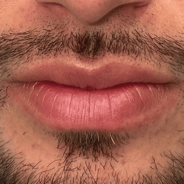 lip_03b.png