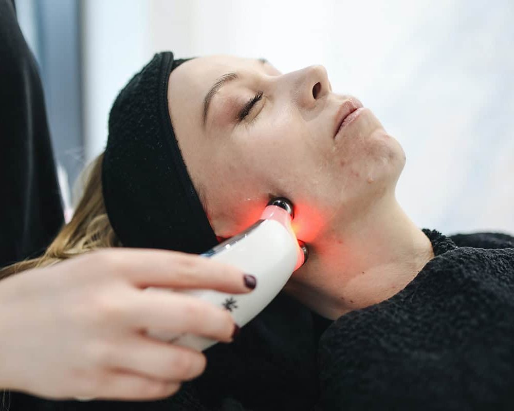 halo + prp face treatment