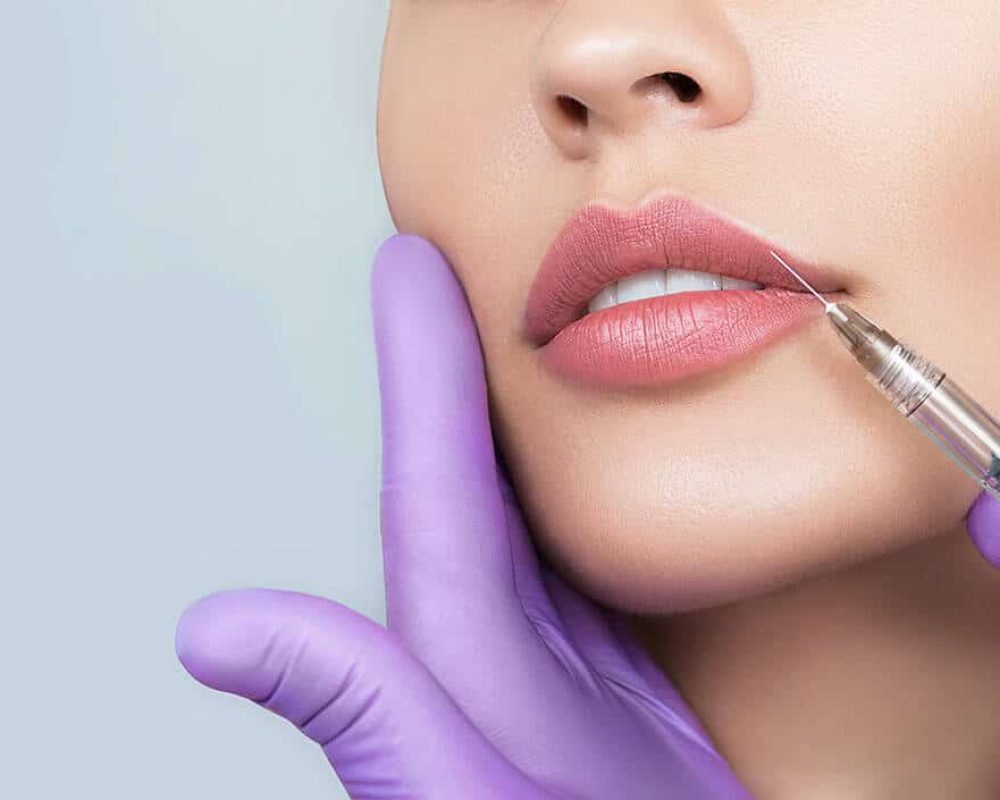 model getting lip filler