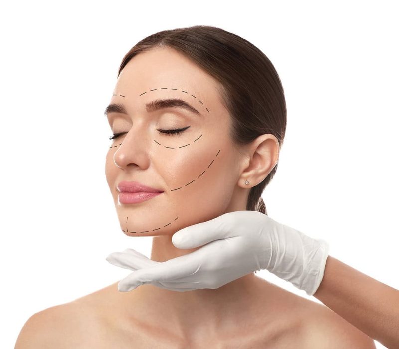 markings on face