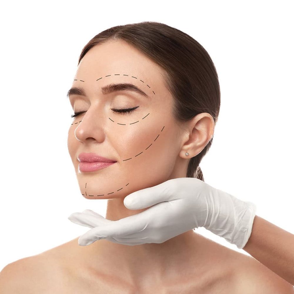 markings on face