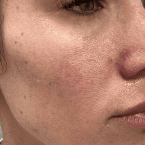 skinvive_01a-1.png