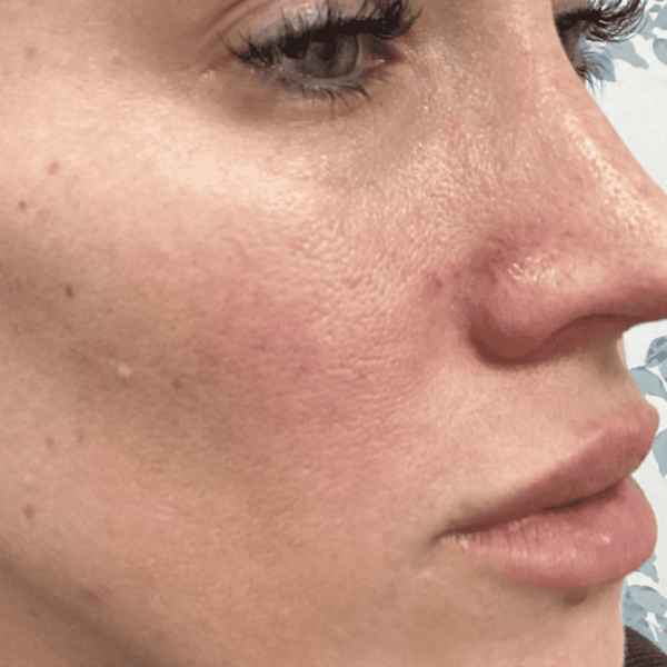 skinvive_01b-1.png